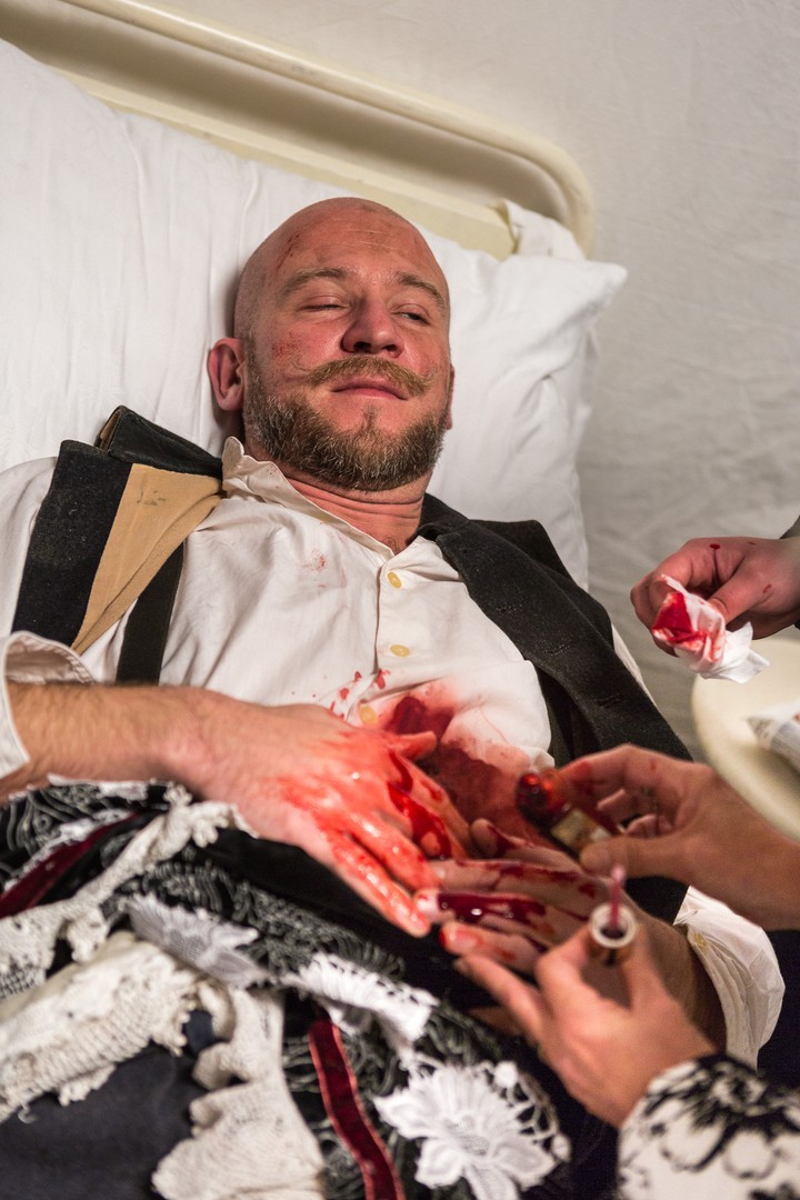 1890 -  Nahalka zranenie